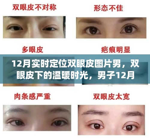 男子雙眼皮恢復(fù)之旅，冬季溫暖時光與友情的碰撞