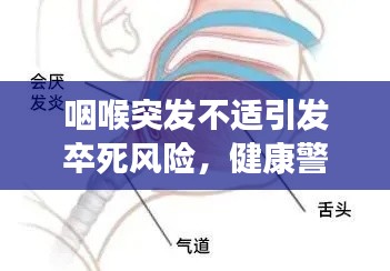 咽喉突發(fā)不適引發(fā)卒死風(fēng)險(xiǎn)，健康警鐘長(zhǎng)鳴！