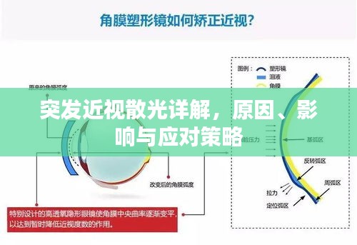 突發(fā)近視散光詳解，原因、影響與應(yīng)對策略