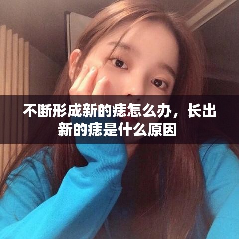 不斷形成新的痣怎么辦，長出新的痣是什么原因 