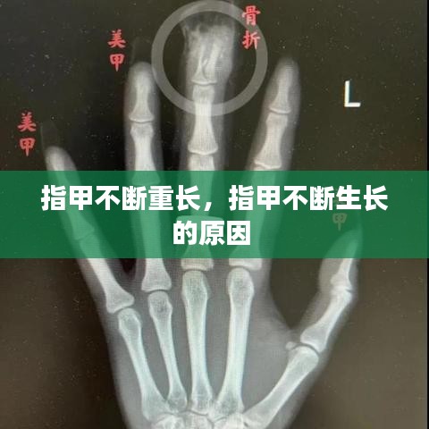 指甲不斷重長，指甲不斷生長的原因 
