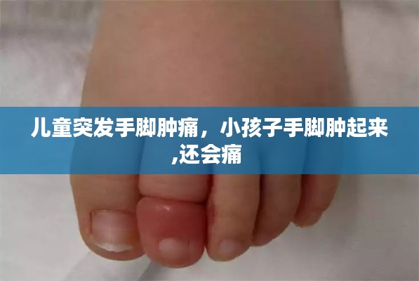 兒童突發(fā)手腳腫痛，小孩子手腳腫起來(lái),還會(huì)痛 