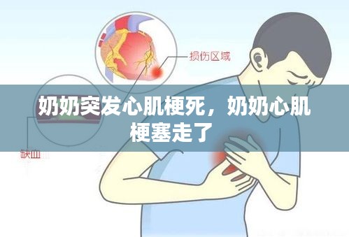 奶奶突發(fā)心肌梗死，奶奶心肌梗塞走了 