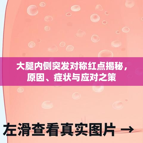 大腿內(nèi)側(cè)突發(fā)對(duì)稱紅點(diǎn)揭秘，原因、癥狀與應(yīng)對(duì)之策