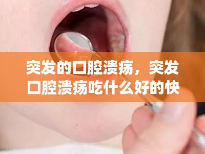突發(fā)的口腔潰瘍，突發(fā)口腔潰瘍吃什么好的快 