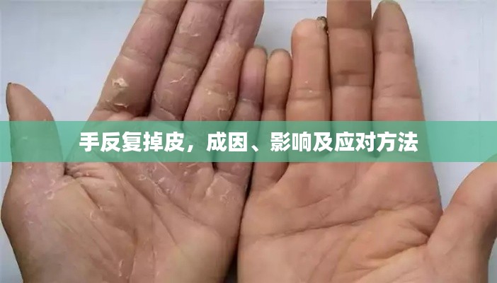 手反復掉皮，成因、影響及應對方法