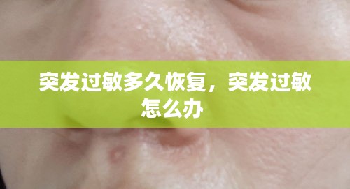 突發(fā)過敏多久恢復，突發(fā)過敏怎么辦 
