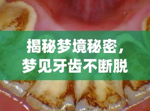 揭秘夢境秘密，夢見牙齒不斷脫落的背后含義
