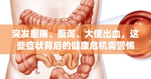 突發(fā)腹痛、腹瀉、大便出血，這些癥狀背后的健康危機(jī)需警惕！