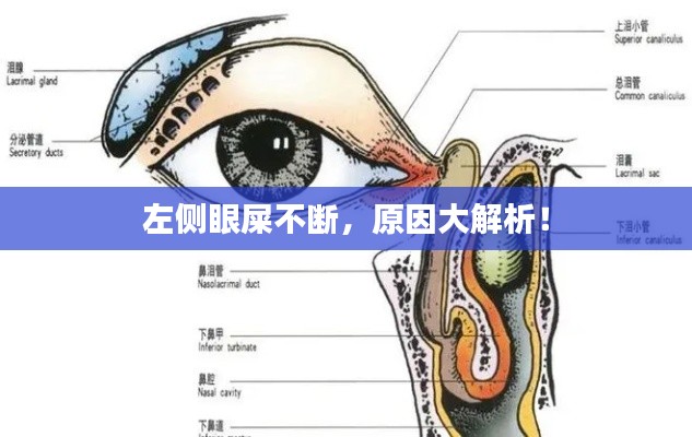 左側(cè)眼屎不斷，原因大解析！