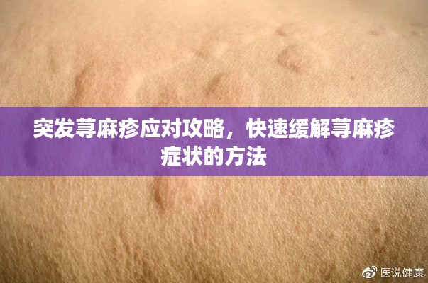 突發(fā)蕁麻疹應(yīng)對(duì)攻略，快速緩解蕁麻疹癥狀的方法