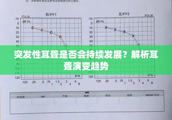 突發(fā)性耳聾是否會持續(xù)發(fā)展？解析耳聾演變趨勢