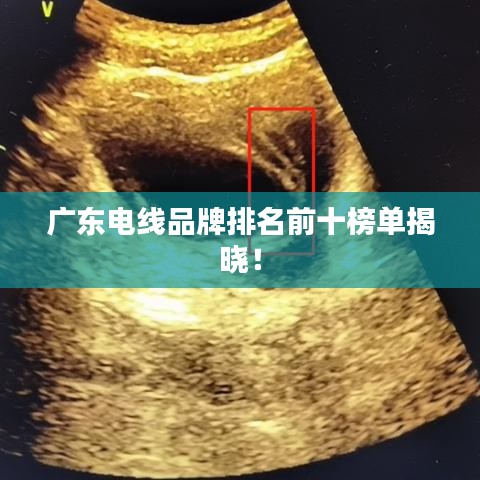 廣東電線品牌排名前十榜單揭曉！
