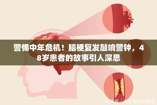 警惕中年危機(jī)！腦梗復(fù)發(fā)敲響警鐘，48歲患者的故事引人深思